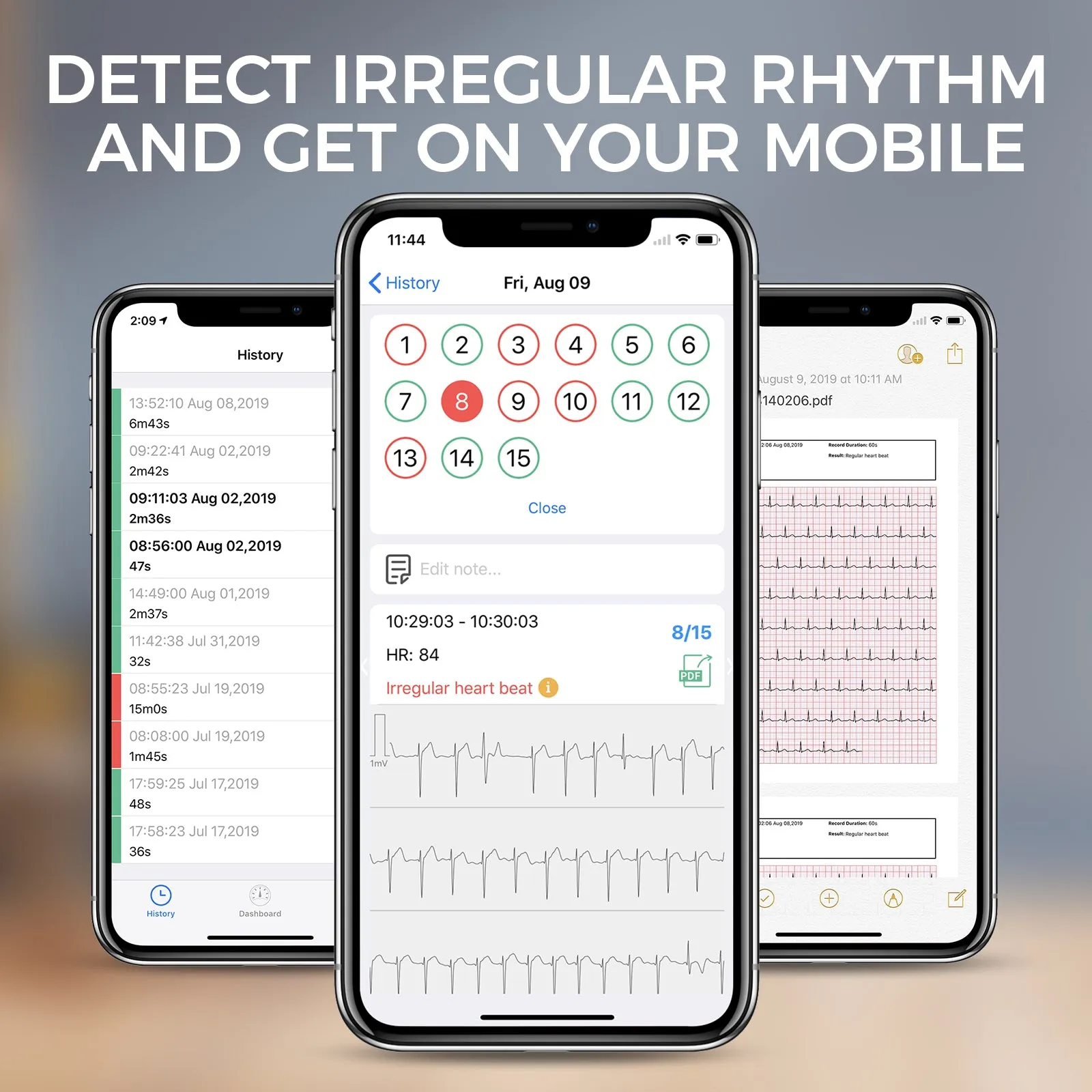 DuoEK Portable ECG Heart Rate Monitor